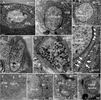 Neurexin and Neuroligins Maintain the Balance of Ghost and Satellite Boutons at the Drosophila Neuromuscular Junction